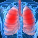 Аномалии развития органов дыхания