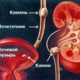 Острая недостаточность почек её причины симптомы