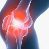 Травма коленного сустава у человека