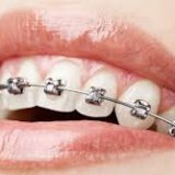 Ортодонтия важная отрасль стоматологии