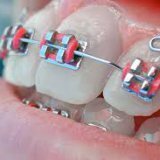 Когда человеку нужна помощь стоматолога ортодонта