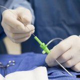 Бескровная хирургия операция без разреза