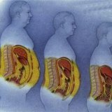 Ожирение вызывает патологию желудочно-кишечного тракта
