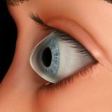 Заболевание роговицы глаза кератоконус