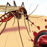Симптомы малярии и причины ее возникновения