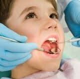 Кариес молочных зубов у детей